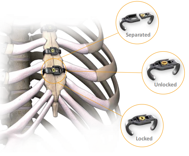 a3b3dfec8d1177502ab6503bc14eda21