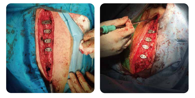 98a5ae34132f1c513bfafb4354045624